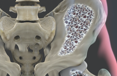 Hip bone image 
